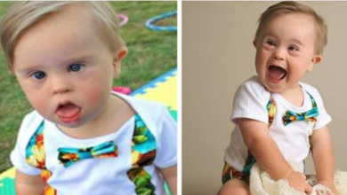 Photo of Baby rejected by modelling agency for having Down syndrome becomes popular, lands ad campaign